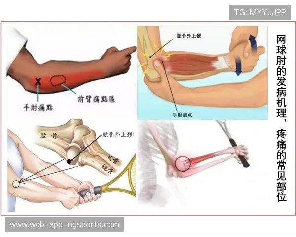 重庆网球队区域防守策略解析与深度剖析网球竞技的战术魅力
